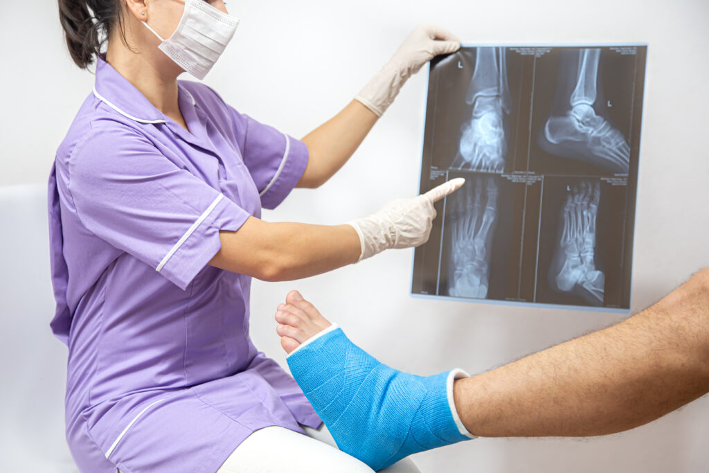 bone fracture