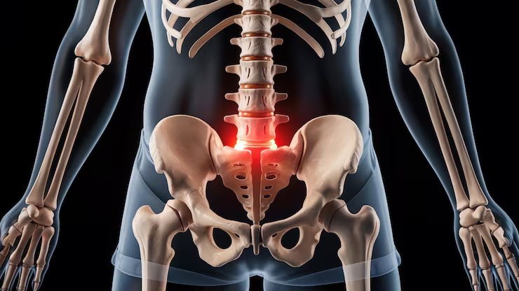 hip replacement