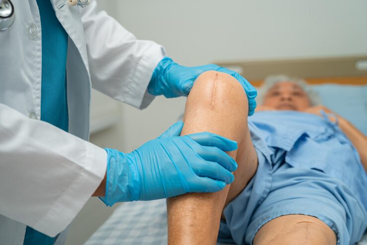 knee replacement surgery